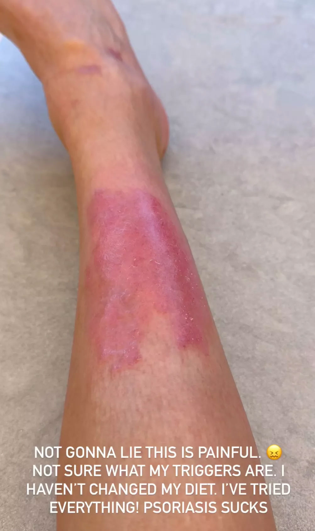 Kim Kardashian stressful life affecting her skin?