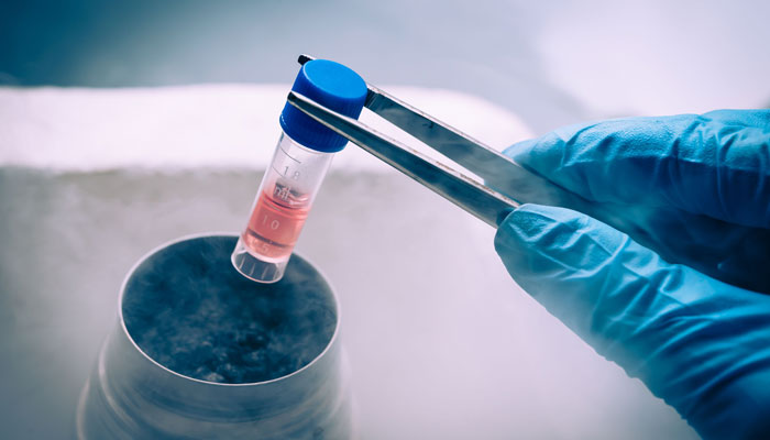 An individual holding an IVF bottle ready to be frozen. — Los Angeles Reproductive Center