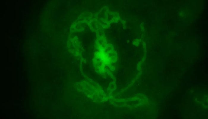 A fluorescent image of a testicular organoid created from mouse embryos and incubated in a dish for 14 days.—SWNS