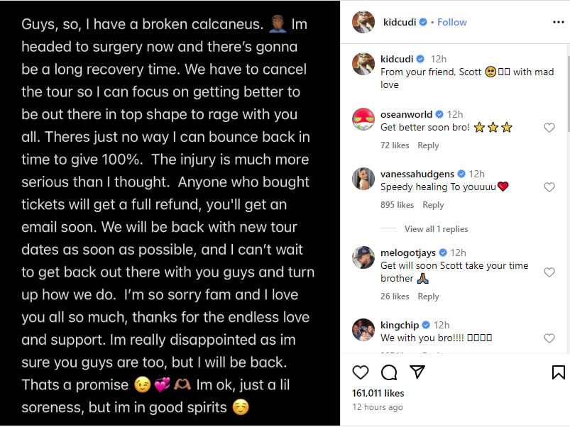 Rapper Kid Cudi postpones his upcoming tour due to major surgery