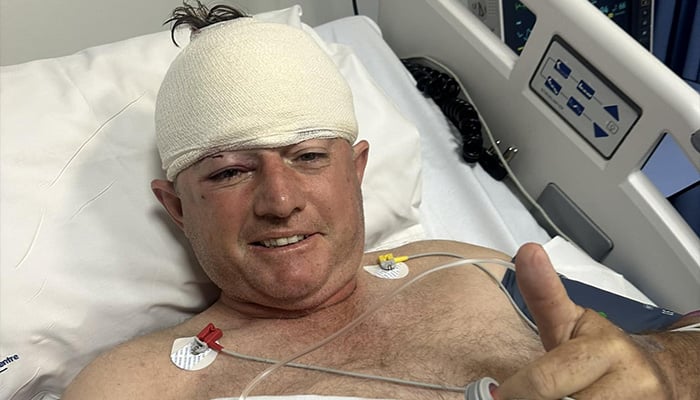 Former Zimbabwe cricketer Guy Whittall hospitalised after a leopard attack. — Facebook/@hannah.stookswhittall