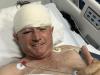 Former Zimbabwean cricketer Guy Whittall injured in leopard attack