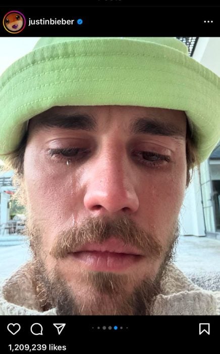 Justin Bieber sparks concern with crying snaps: See pic