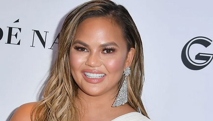 Chrissy Teigen suffers major injury ahead of Met Gala