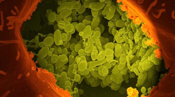 Gut bacteria, viruses likely to increase risk of type 2 diabetes