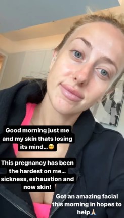 Brittany Mahomes reveals why her third pregnancy is ‘the hardest