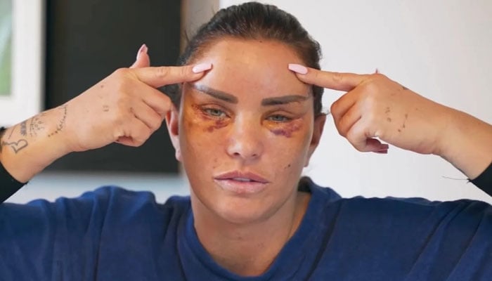 Katie Price sparks outrage over Turkey plastic surgery