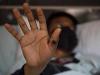 Pakistan issues alert after surge in monkeypox cases globally
