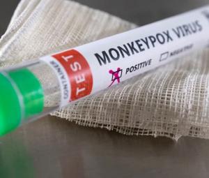 Pakistan reports 1st monkeypox case of 2024 as disease declared global health emergency