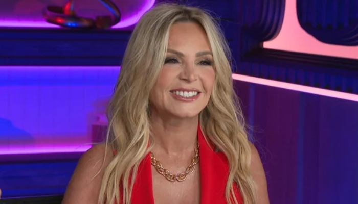 Tamra Judge up-and-close about plastic surgery procedure