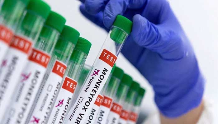 First case of latest mpox variant detected in UK: health authority