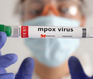 Pakistan's mpox tally reaches 8 as another case reported in Islamabad