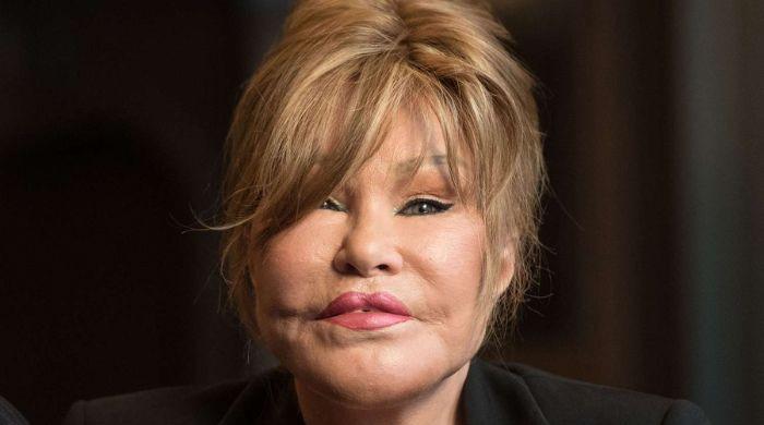 The shocking truth behind Jocelyn Wildenstein's unexpected passing revealed