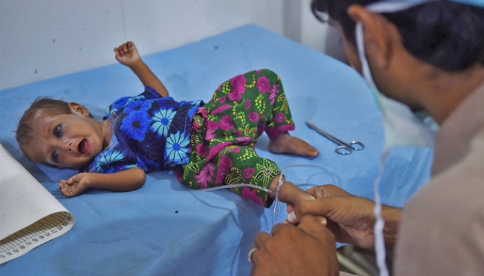 A doctor treats a little girl at the Mithi Civil Hospital, in Mithi, Sindh, on May 25, 2018. — AFP/File