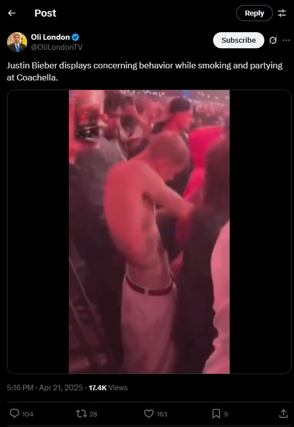 Justin Bieber sparks another wave of concern amid his drugged up state