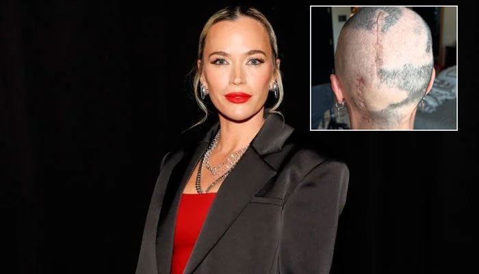 Teddi Mellencamp reflects on her ongoing cancer journey