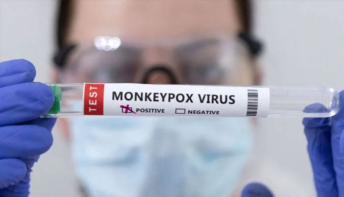 Test tubes labelled Monkeypox virus positive are seen in this illustration taken on May 23, 2022. — Reuters