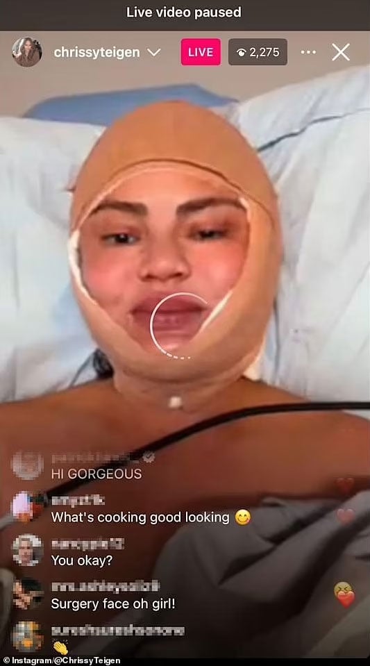 Chrissy Teigens surgery details come to light