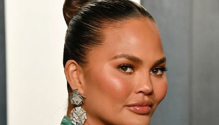 Details about Chrissy Teigens surgery revealed
