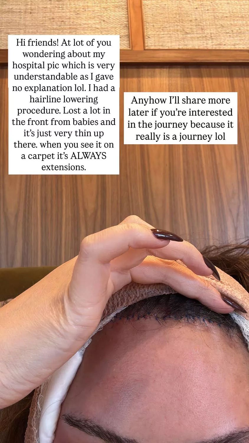 Chrissy Teigen breaks silence as her bandaged face goes viral