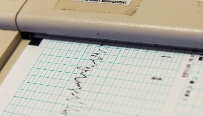 A representational image of a Richter scale. — Canva