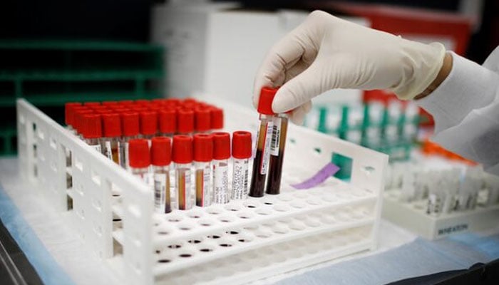 A health worker takes test tubes with plasma and blood samples after a separation process in a centrifuge during a coronavirus disease (COVID-19) vaccination study at the Research Centers of America, in Hollywood, Florida, U.S., September 24, 2020. — Reuters
