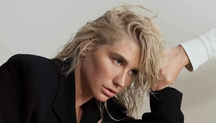 Photo: Kesha recounts receiving support from Cyndi Lauper amid 2018 Grammy Awards performance