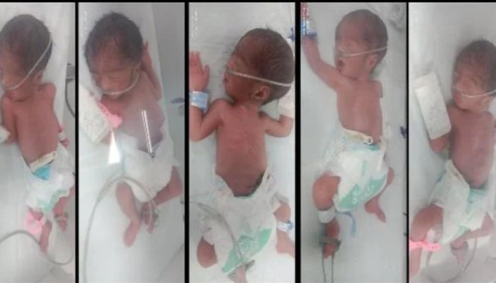 Quintuplets born to Karachi couple. — Reporter