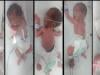 Karachi couple welcomes quintuplets in rare birth