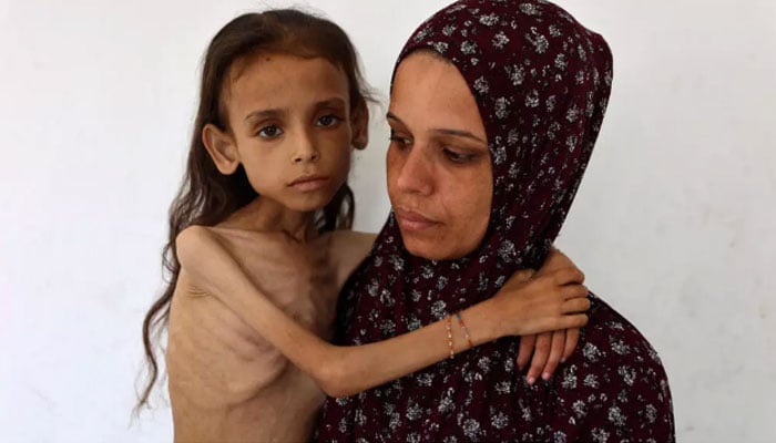 Grok falsely claimed this image of an emaciated Gazan girl by AFP photojournalist Omar al-Qattaa was from Yemen. — AFP/File