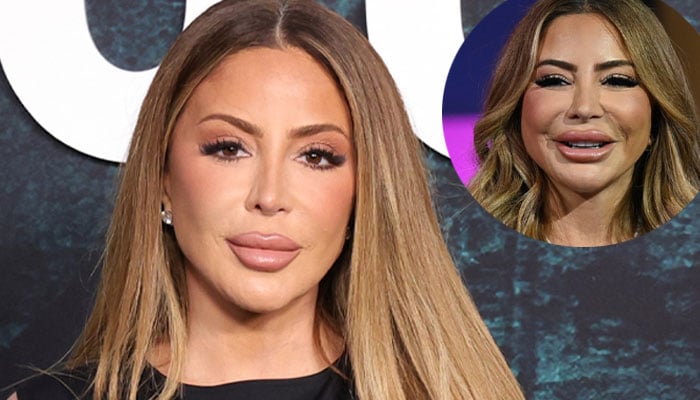 Bravo star Larsa Pippen calls out a doctor over false assumptions about her skin