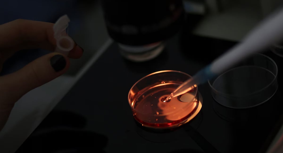 An employee of Kheiron Biotech sorts developing eggs or oocytes, from horses, at the companys laboratory in Pilar, Buenos Aires. — Reuters