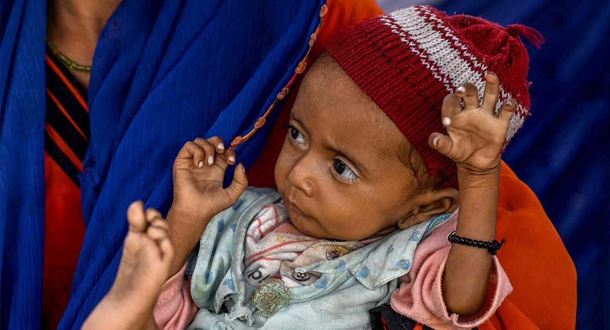 This photograph taken on July 29, 2025 shows a child in her mother´s arms during a UNICEF nutrition programme at Fateh Muhammad Soomro village in the Sujawal district of Sindh.