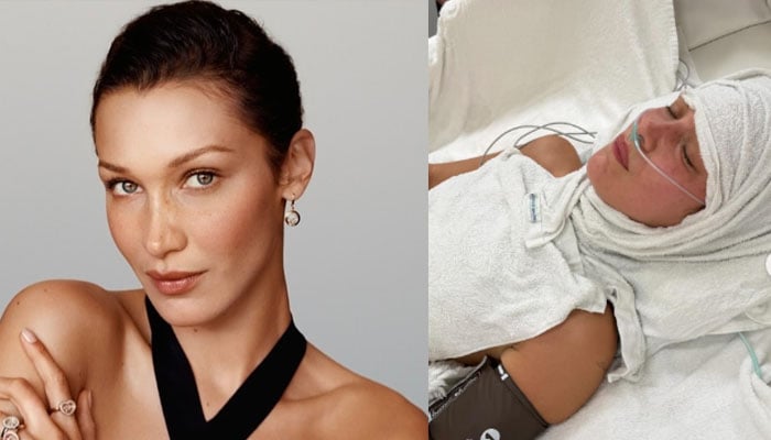 What happened to Bella Hadid?