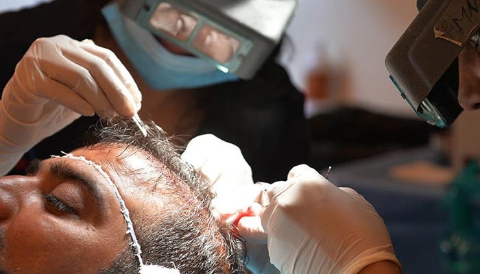 This photograph taken on October 16, 2014, shows doctors treating a patient for hair transplants at a clinic in Islamabad. — AFP