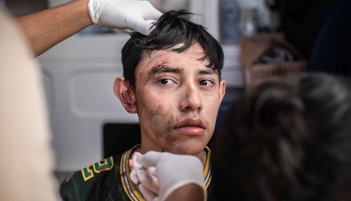 A young man receives medical attention in the municipality of Alamo, Veracruz state, Mexico, on October 12, 2025. — AFP