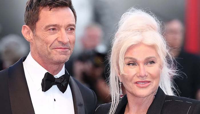 Hugh Jackman face professional setback after cheating scandal