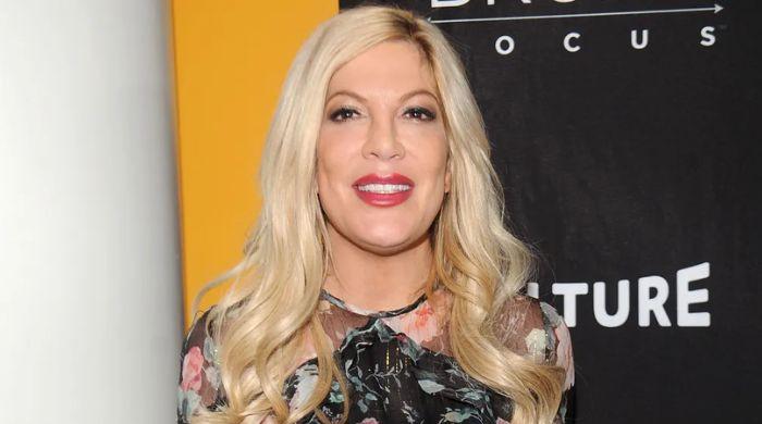 Tori Spelling reveals what she endured due to eczema
