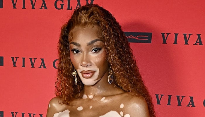 Winnie Harlow reacts to backlash over cosplaying Whitney Houston on Halloween