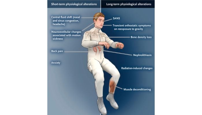 NASA confirms long spaceflights harm astronauts’ eyes, jeopardizing Mars missions