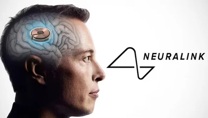 Elon Musks Neuralink to face a challenger, and its more sophisticated