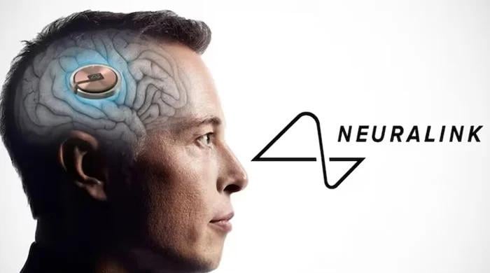 Elon Musk's Neuralink to face challenger, and it's more advanced