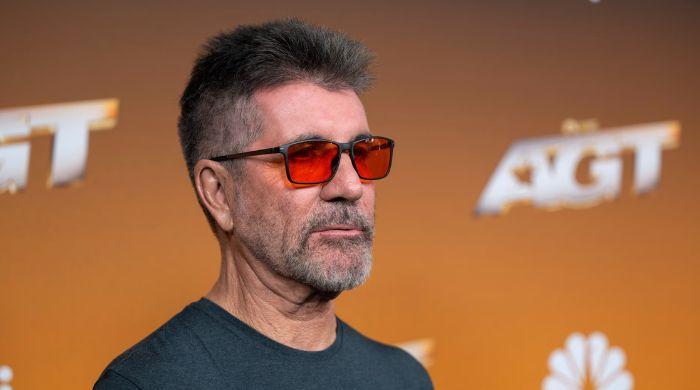 Simon Cowell gets candid about getting cosmetic surgeries 