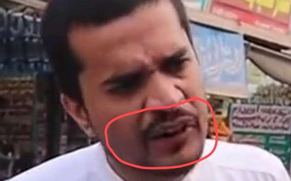 The cyclist seen in the video has unnatural lips and teeth, indicating it was created using AI.