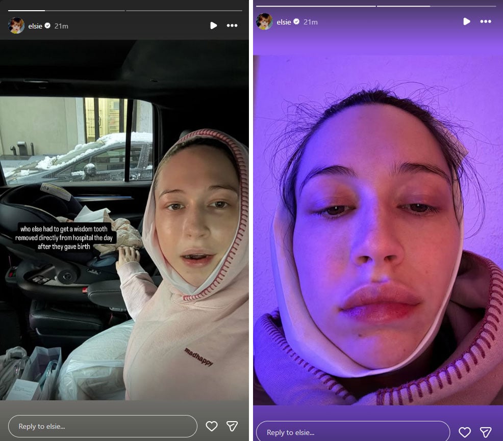 Pete Davidsons partner shares painful update hours after baby announcement