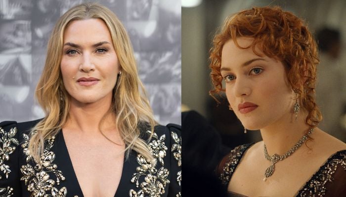 Kate Winslet admits losing sleep due to constant media attention