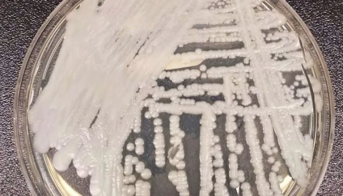 ‘Superbug’ fungus infections approach record high in US