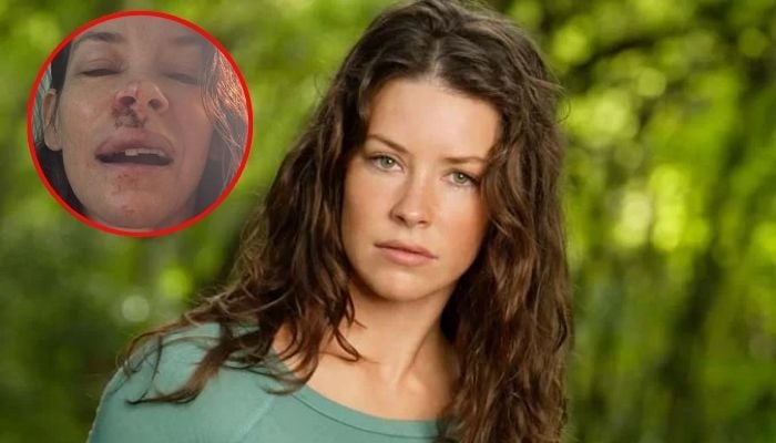 ‘Avengers: Endgame’ star Evangeline Lilly reveals brain damage in health update after Hawaii accident