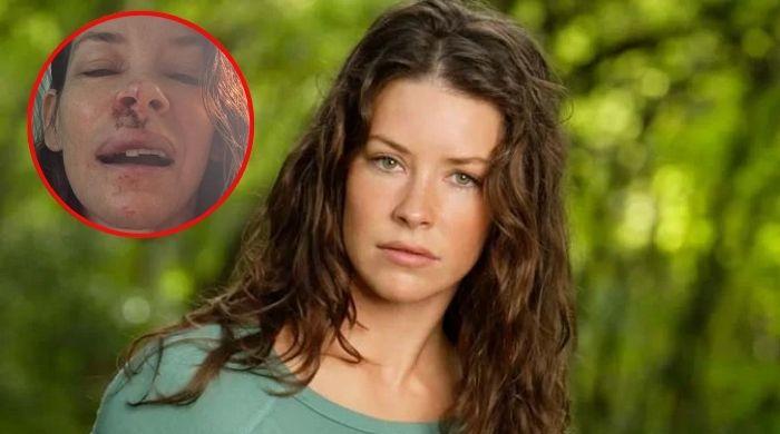 ‘Avengers: Endgame' star Evangeline Lilly reveals brain damage in health update after Hawaii accident