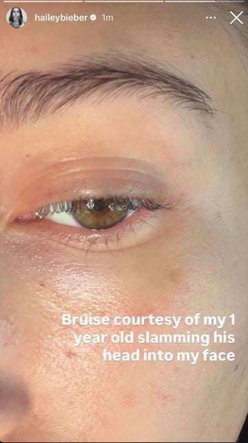 Hailey Bieber shares unfiltered look at life as mom